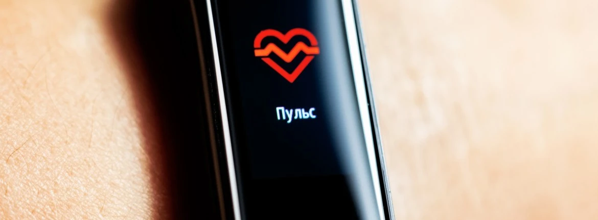 Xiaomi MI Band 5 – az olcsó okosórák legújabb generációja