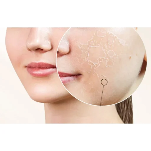 Feszesítő arcápoló készülék ANLAN 01-AVLY41-02A - 6