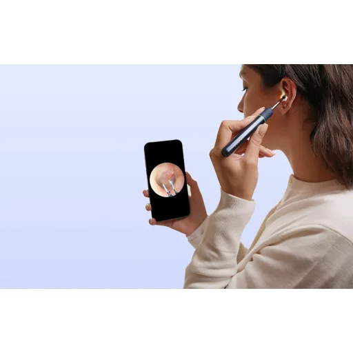 Bebird Note 5 Pro (kék) fültisztító - 7