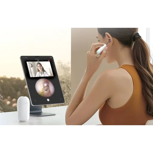 Bebird Home 30S fültisztító otoszkóp (fehér) - 9