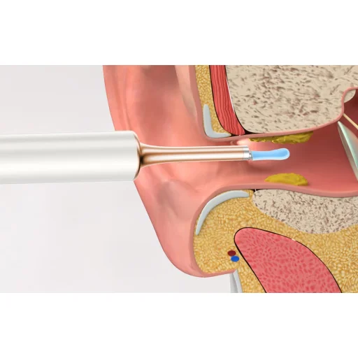 Bebird Note 5 Pro fülszonda (fehér) - 7