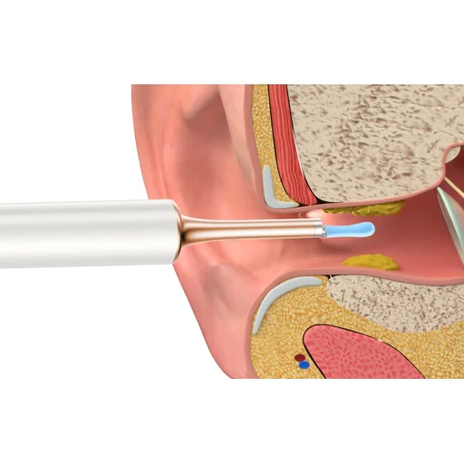 Bebird T15 fültisztító kamera fehér - 5