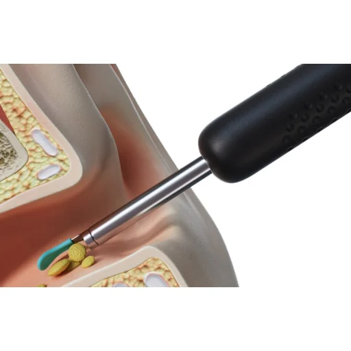 Bebird R1 fekete fültisztító - 5