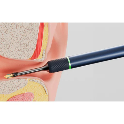 Intelligens Vizuális Fültisztító Pálca Bebird Note 5 (kék) - 7