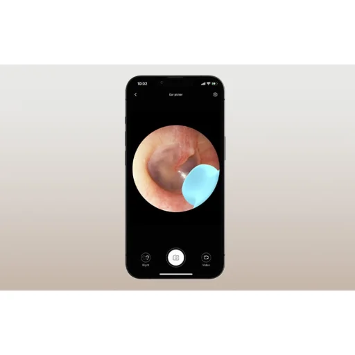 Bebird M9 S fültisztító készülék (fekete) - 4