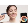 Bebird EarSight Plus fültisztító kamera otoszkóp (kék) thumbnail
