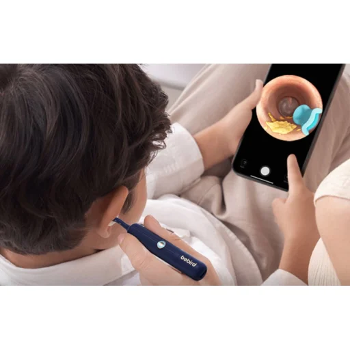 Bebird EarSight Plus fültisztító kamera otoszkóp (kék) - 8