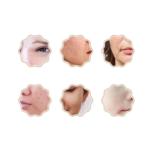 Vízálló maszk fényterápiával ANLAN 01-AGZMZ - 8