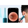 Otoskop s kamerou na čistenie uší Bebird Earsight Ultra thumbnail