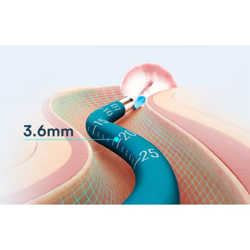 Otoskop s kamerou na čistenie uší Bebird Earsight Ultra - 5