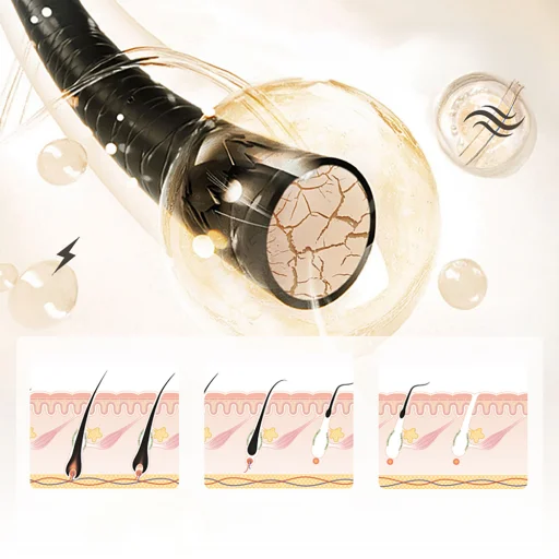MAXGROOM JD-TM003 IPL epilátor na odstraňovanie chĺpkov - biely a ružový - 4