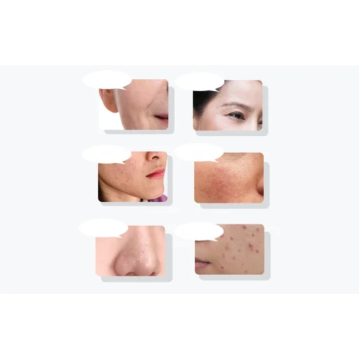 ANLAN 01-ADRY15-001 Ultrahangos arcmasszírozó fényterápiával - 6